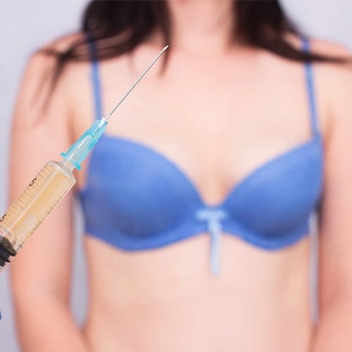 lipofilling mammaire augmentation mammaire seins poitrine dr jerry levy chirurgien esthetique specialiste chirurgie mammaire paris